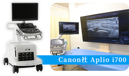 正確なエコーガイドを可能にする超音波診断装置