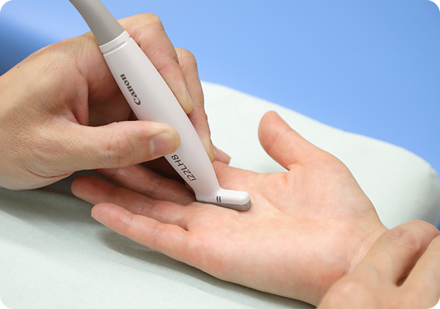 皮膚を切らないから、傷跡がほとんど目立たない